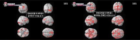 Above are MRI scans of a student who respectively looked at photos of her favorite K-pop star (right) and her boyfriend (left). The contrasts in brain activity, caused by the mPFC (a part of our brain linked to the perception of self) and other love hormones such as oxytocin, between the two results prove how much attachment fans feel for their favorite artist. Photo courtesy of SBS.